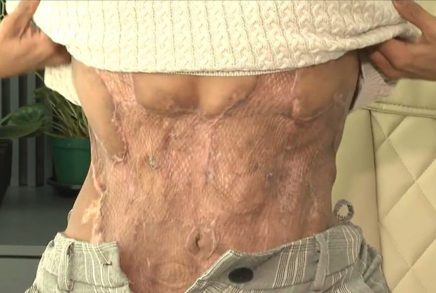 cirurgiao-plastico-condenado-por-lesao-grave-e-proibido-de-exercer-medicina