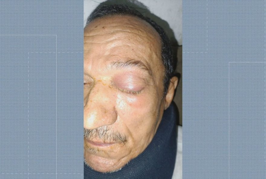 cirurgias-suspensas-apos-pacientes-perderem-visao-em-hospital-de-mage3A-autoridades-investigam-casos-de-infeccao-ocular