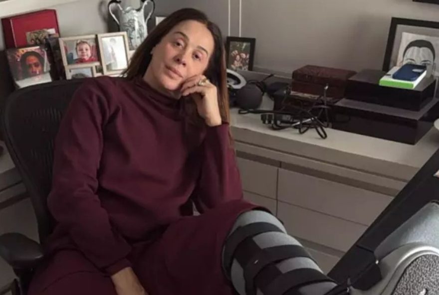 claudia-raia-fratura-tornozelo-e-cancela-apresentacoes-no-rio-e-na-paraiba