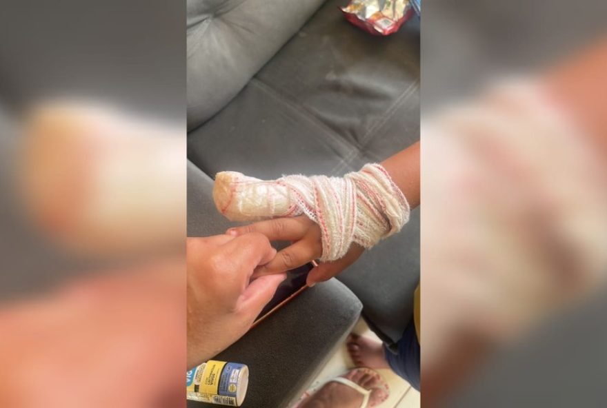 crianca-de-4-anos-tem-dedo-amputado-em-creche-de-sorocaba3A-familia-denuncia-falhas-no-atendimento crianca-de-4-anos-tem-dedo-amputado-em-creche-de-sorocaba3A-familia-denuncia-falhas-no-atendimento