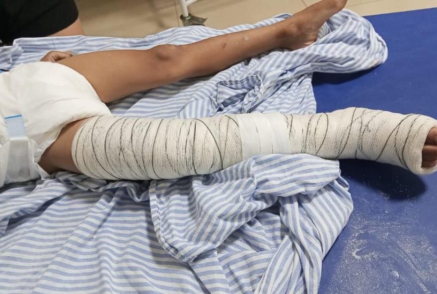 crianca-de-5-anos-atropelada-por-motociclista-que-fugiu-em-ilha-solteira3A-gravidade-e-medidas-necessarias crianca-de-5-anos-atropelada-por-motociclista-que-fugiu-em-ilha-solteira3A-gravidade-e-medidas-necessarias