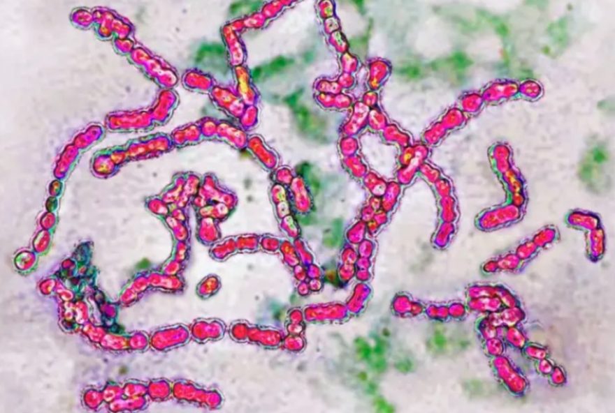 crianca-de-6-anos-falece-por-infeccao-grave-em-curitiba3A-alerta-de-estreptococo-do-grupo-a crianca-de-6-anos-falece-por-infeccao-grave-em-curitiba3A-alerta-de-estreptococo-do-grupo-a