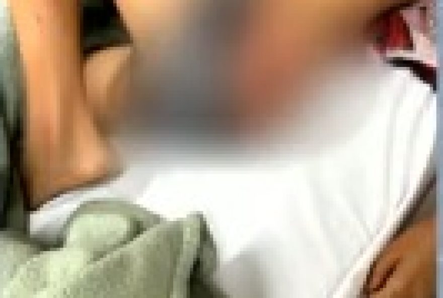 crianca-de-7-anos-e-ferida-em-ataque-de-pit-bull-em-itumbiara