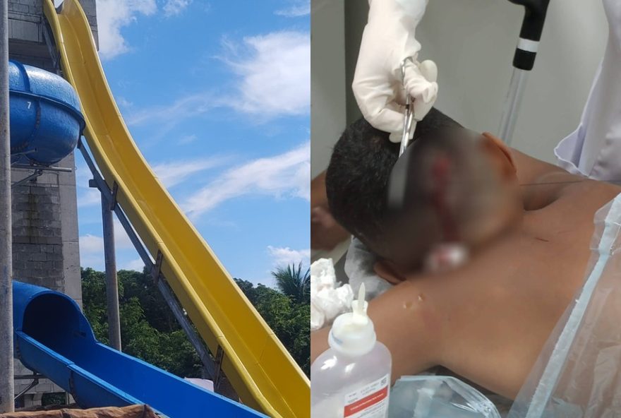 crianca-se-fere-em-toboga3A-pai-denuncia-tentativa-de-suborno-no-parque-aquatico-em-abreu-e-lima crianca-se-fere-em-toboga3A-pai-denuncia-tentativa-de-suborno-no-parque-aquatico-em-abreu-e-lima