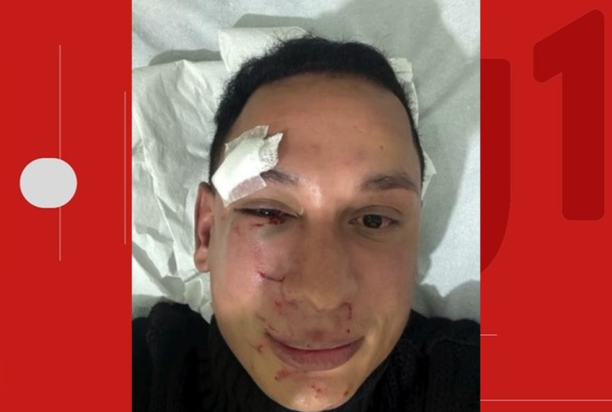 dentista-agredido-em-camarote-privado-no-sao-joao-de-irece3A-trauma-fisico-e-psicologico