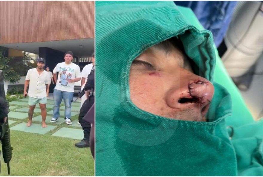 denuncia-de-agressao3A-jogador-argentino-morde-e-corta-nariz-de-homem-no-ceara denuncia-de-agressao3A-jogador-argentino-morde-e-corta-nariz-de-homem-no-ceara