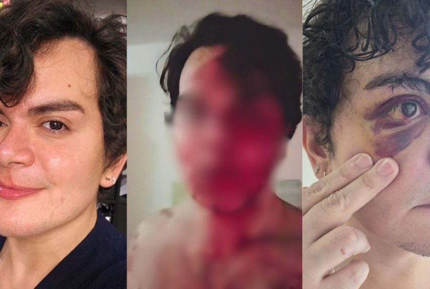 dermatologista-sofre-homofobia-e-lesao-corporal-em-recife3A-caso-gera-debate-sobre-seguranca-lgbtq2B dermatologista-sofre-homofobia-e-lesao-corporal-em-recife3A-caso-gera-debate-sobre-seguranca-lgbtq2B