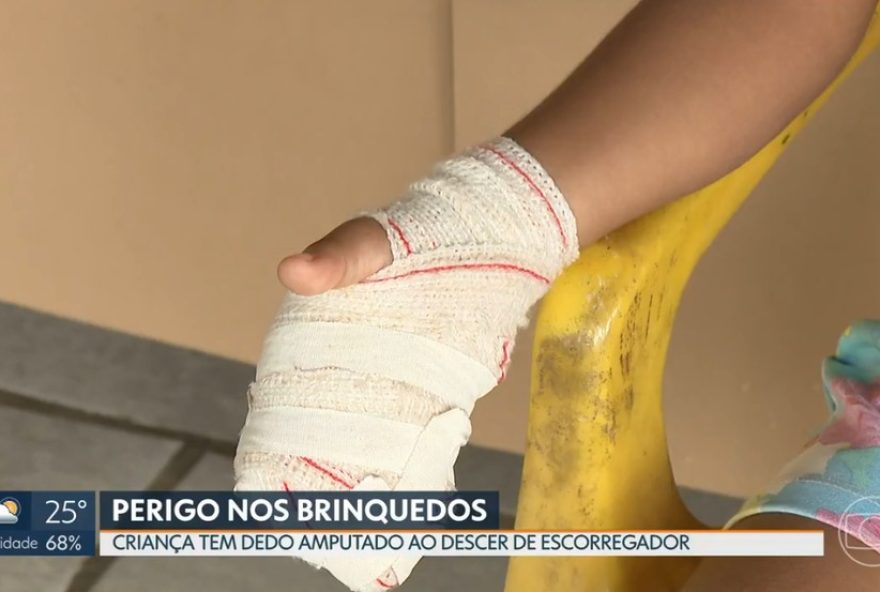 df-condenado-a-indenizar-crianca-por-dedo-mutilado-em-parquinho