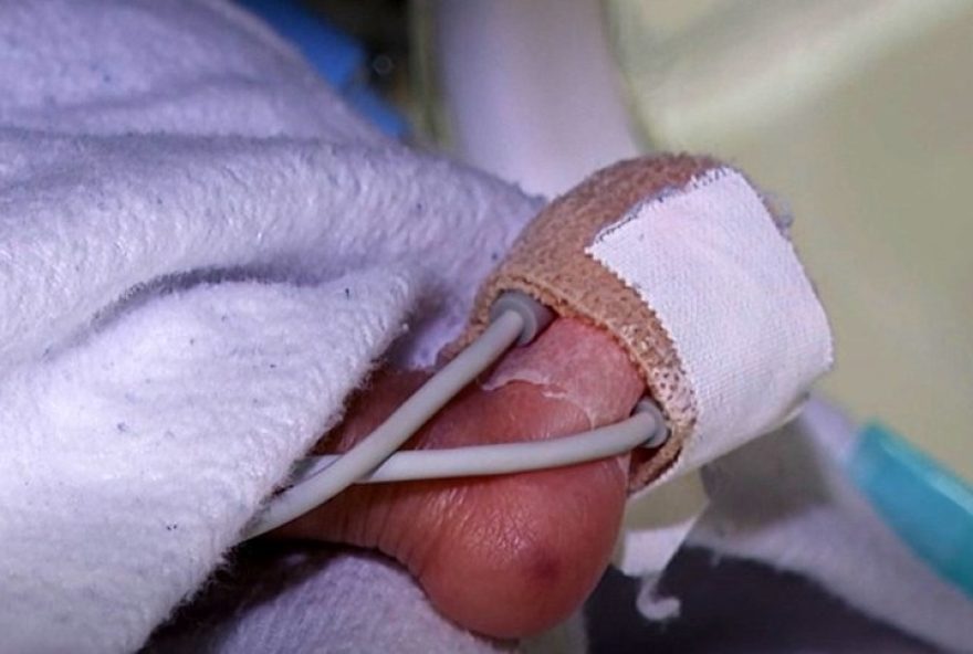 dia-mundial-da-prematuridade3A-para-tem-mais-de-9-mil-nascimentos-prematuros-em-2025.-novembro-roxo-alerta-para-cuidados-essenciais dia-mundial-da-prematuridade3A-para-tem-mais-de-9-mil-nascimentos-prematuros-em-2025.-novembro-roxo-alerta-para-cuidados-essenciais