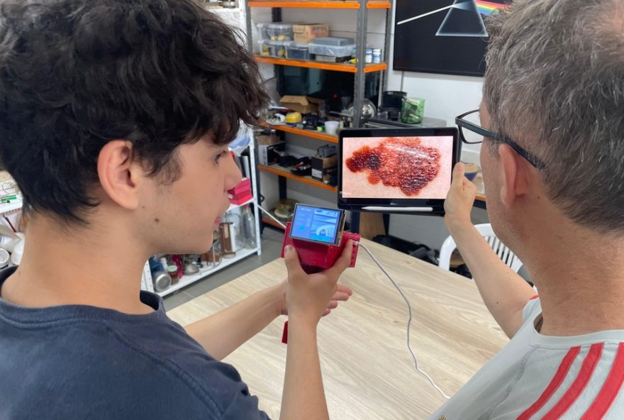 dispositivo-com-ia-detecta-cancer-de-pele3A-conheca-o-skinscan