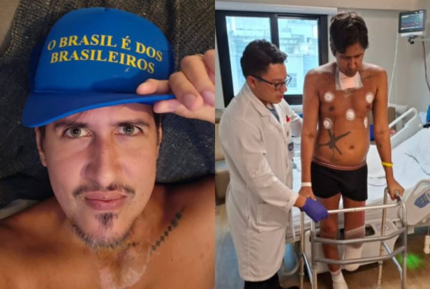 dj-julio-ele-mesmo-processa-hospital-apos-40-dias-em-coma-e-amputacoes