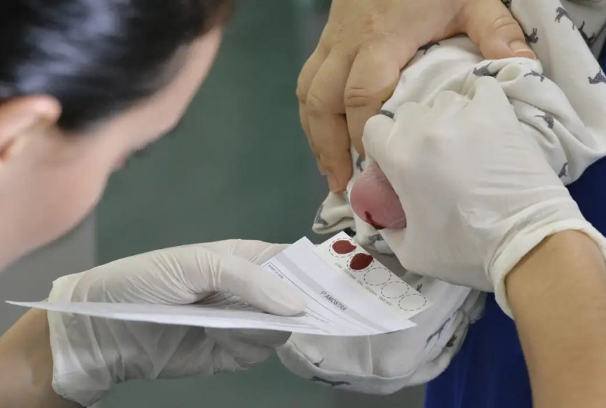 Teste do pezinho pode diagnosticar patologia de forma precoce