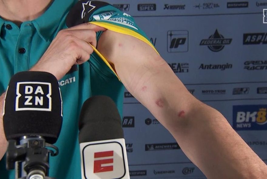 el-mal-estado-del-asfalto-en-brasil-deja-moratones-en-los-pilotos-en-el-autodromo-de-goiania el-mal-estado-del-asfalto-en-brasil-deja-moratones-en-los-pilotos-en-el-autodromo-de-goiania