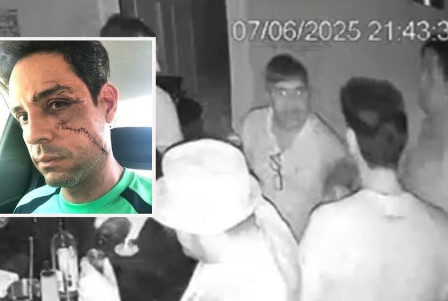 empresario-agredido-com-copo-de-vidro-busca-justica-em-fortaleza3A-22eu-so-desejava-sobreviver22