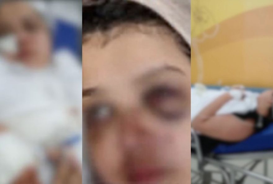 enfermeira-relata-tentativa-de-feminicidio-pelo-ex3A-caso-em-sao-luis-deve-alertar-sobre-violencia-domestica-e-necessidade-de-apoio-as-vitimas enfermeira-relata-tentativa-de-feminicidio-pelo-ex3A-caso-em-sao-luis-deve-alertar-sobre-violencia-domestica-e-necessidade-de-apoio-as-vitimas