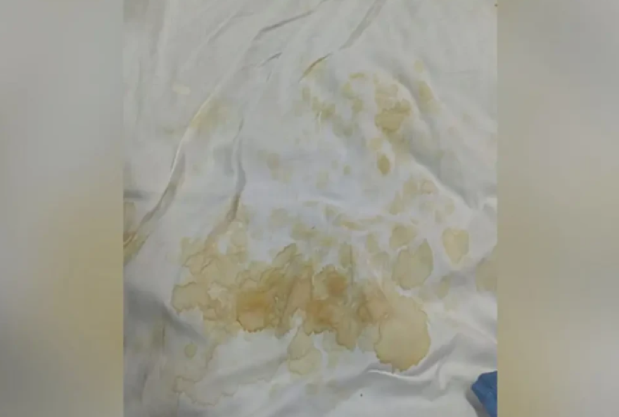 falta-de-lencois-gera-insatisfacao-de-pacientes-no-hugol2C-em-goiania falta-de-lencois-gera-insatisfacao-de-pacientes-no-hugol2C-em-goiania