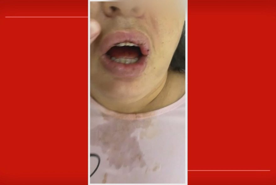 familia-denuncia-agressoes-e-tortura-em-clinica-psiquiatrica-do-df3A-paciente-em-estado-grave-no-hospital familia-denuncia-agressoes-e-tortura-em-clinica-psiquiatrica-do-df3A-paciente-em-estado-grave-no-hospital