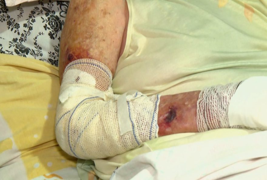 familia-denuncia-idosa-acamada-ferida-em-upa-de-rio-claro3A-queremos-justica familia-denuncia-idosa-acamada-ferida-em-upa-de-rio-claro3A-queremos-justica