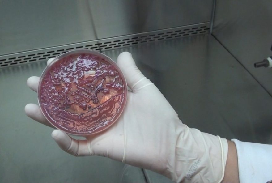 familia-denuncia-risco-de-contagio-por-kpc-no-hospital-mario-gatti familia-denuncia-risco-de-contagio-por-kpc-no-hospital-mario-gatti