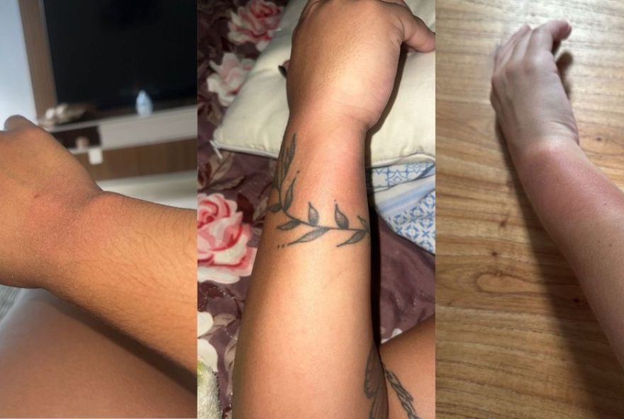 fas-relatam-queimaduras-apos-uso-de-pulseira-de-show-de-luan-santana