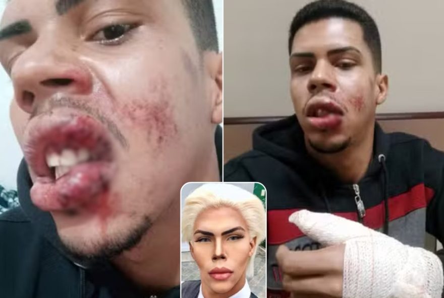 felipe-maximo3A-superacao-apos-acidente-e-fim-da-fase-ken-humano