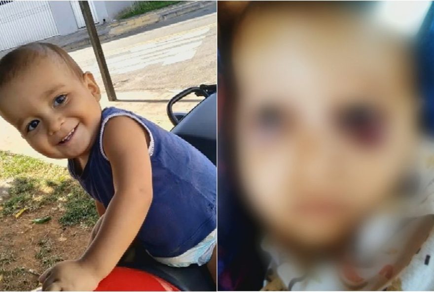 filho-de-1-ano-morre-com-fraturas-e-hematomas3A-laudo-revela-laceracao-no-figado.-pais-e-avo-sob-investigacao2C-pai-esta-preso