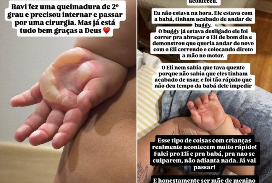 filho-de-viih-tube-e-eliezer-passa-por-cirurgia-apos-queimadura-na-mao filho-de-viih-tube-e-eliezer-passa-por-cirurgia-apos-queimadura-na-mao