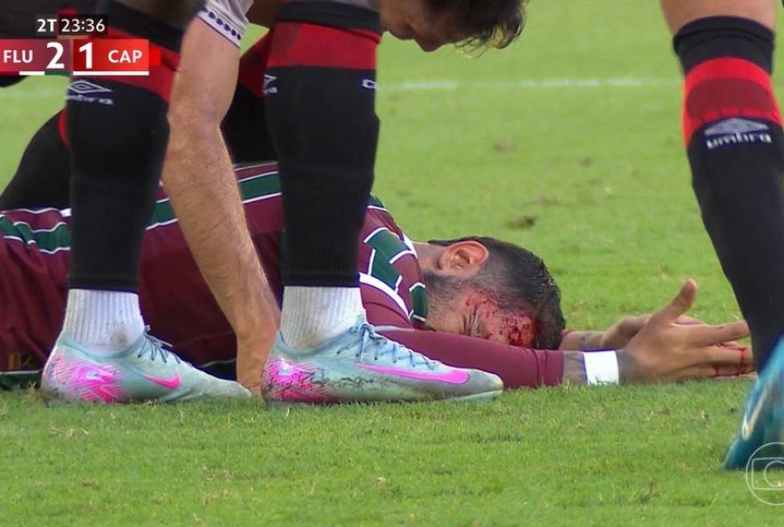 freytes2C-zagueiro-do-fluminense2C-sangra-apos-dividida-com-aguirre-no-maracana freytes2C-zagueiro-do-fluminense2C-sangra-apos-dividida-com-aguirre-no-maracana