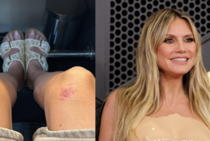 heidi-klum-no-grammy-20263A-vestido-rigido-causa-desconforto-e-debate-sobre-limites-da-moda