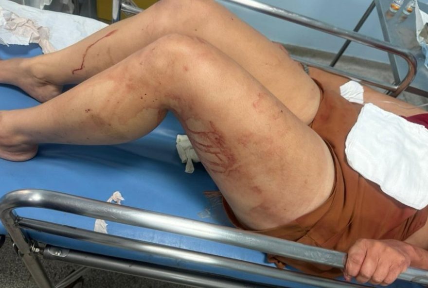 homem-agride-companheira-na-cabeca-em-sumare3A-suspeito-e-preso-apos-vitima-ser-encontrada-com-lesao-grave homem-agride-companheira-na-cabeca-em-sumare3A-suspeito-e-preso-apos-vitima-ser-encontrada-com-lesao-grave