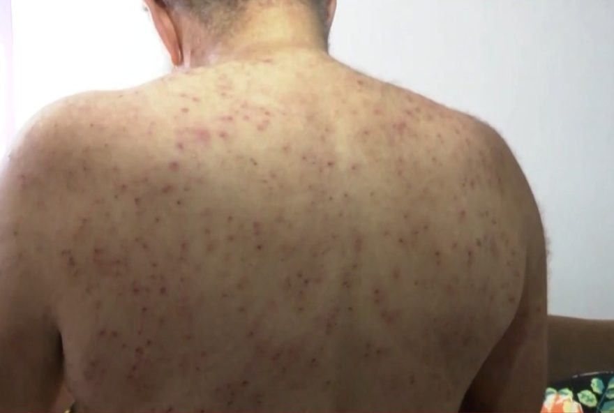 homem-de-68-anos-sobrevive-a-mil-picadas-de-abelha-no-parana3A-relato-de-um-verdadeiro-milagre-e-cuidados-apos-o-ataque homem-de-68-anos-sobrevive-a-mil-picadas-de-abelha-no-parana3A-relato-de-um-verdadeiro-milagre-e-cuidados-apos-o-ataque