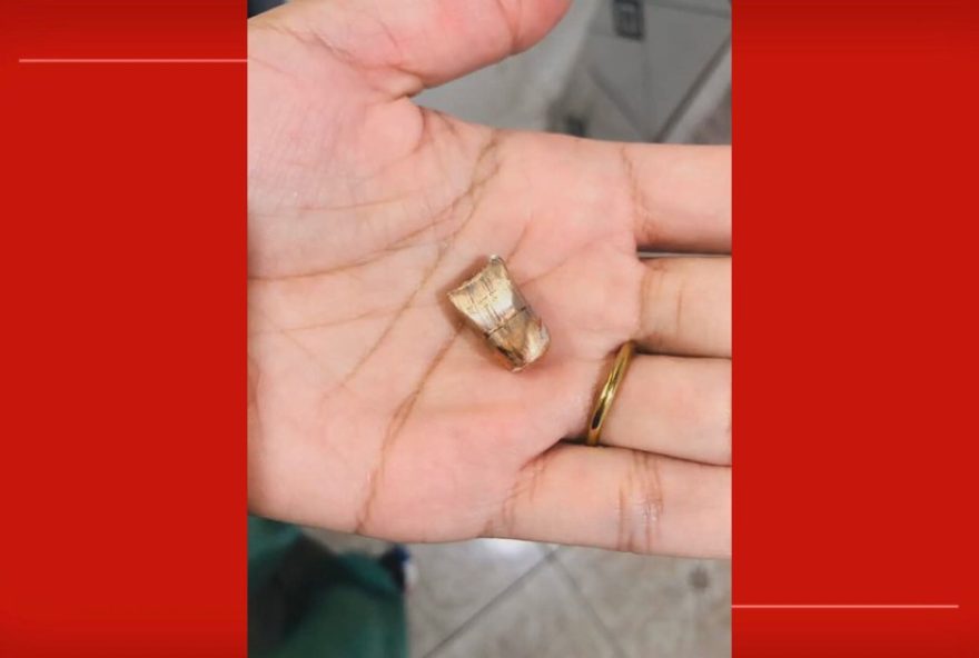 homem-e-atingido-por-bala-perdida-em-casa-no-df3A-origem-do-disparo-desconhecida