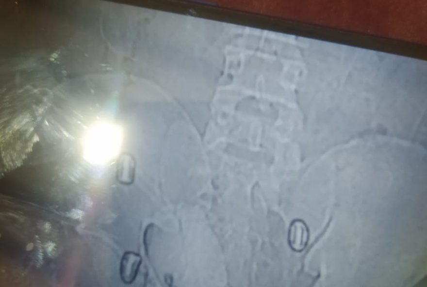 homem-e-detido-por-tentativa-de-homicidio-em-clube-de-copacabana homem-e-detido-por-tentativa-de-homicidio-em-clube-de-copacabana