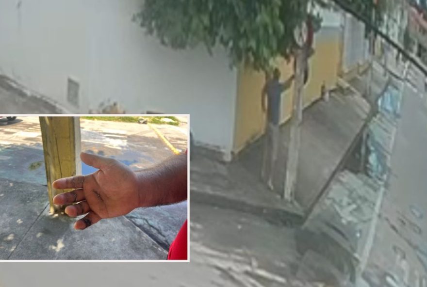homem-perde-movimento-da-mao-apos-choque-em-placa-de-transito-em-fortaleza