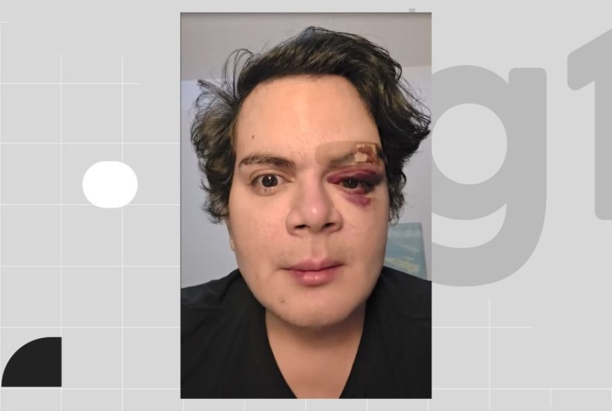 homem-preso-apos-agredir-medico-com-socos-e-ofensas-homofobicas