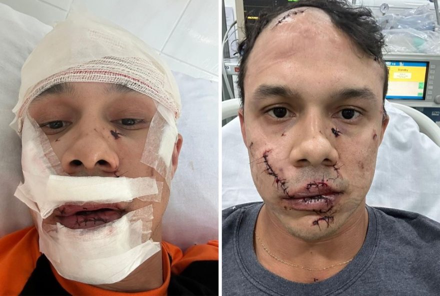 homem-que-agrediu-personal-com-copo-de-vidro-e-identificado-em-df3A-vitima-levou-45-pontos-no-rosto
