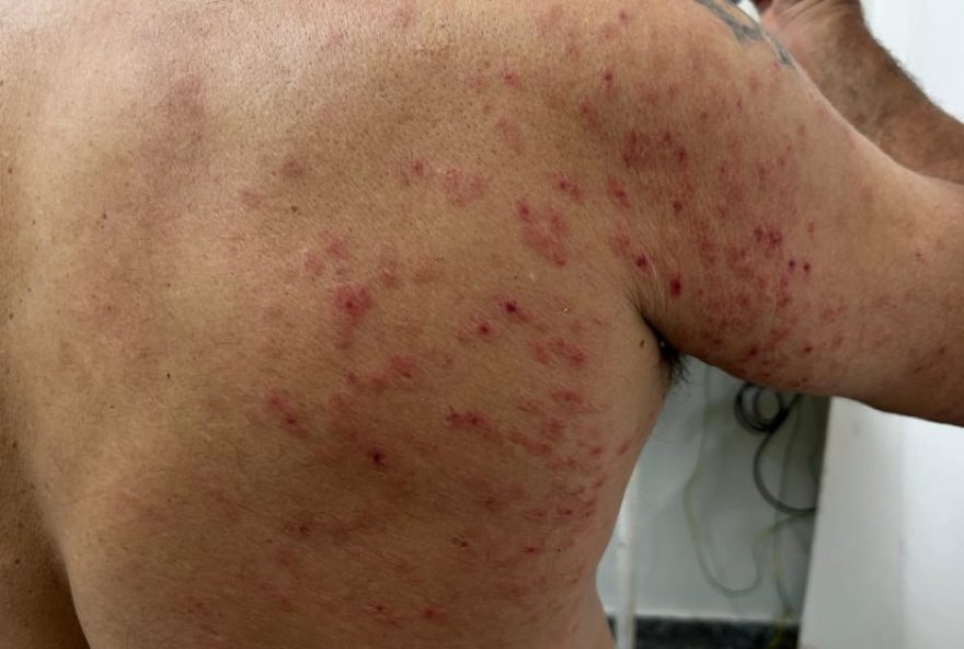 homem-recebe-300-picadas-de-abelhas-em-area-verde-de-sp3A-risco-de-morte-e-descartado