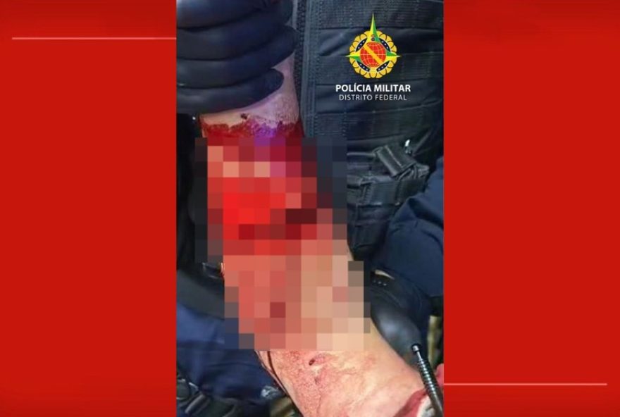 homem-sofre-hemorragia-grave-ao-tentar-invadir-casa-de-ex-no-df3A-video-mostra-agressor-gritando-nome-da-mulher homem-sofre-hemorragia-grave-ao-tentar-invadir-casa-de-ex-no-df3A-video-mostra-agressor-gritando-nome-da-mulher