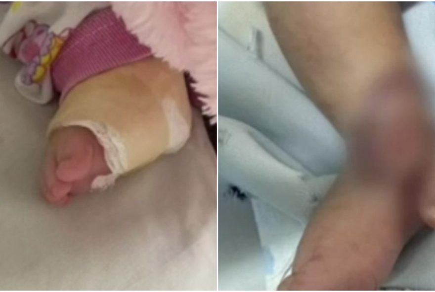 hospital-no-ceara3A-bebe-tem-ferimento-grave-apos-injecao2C-familia-luta-por-justica