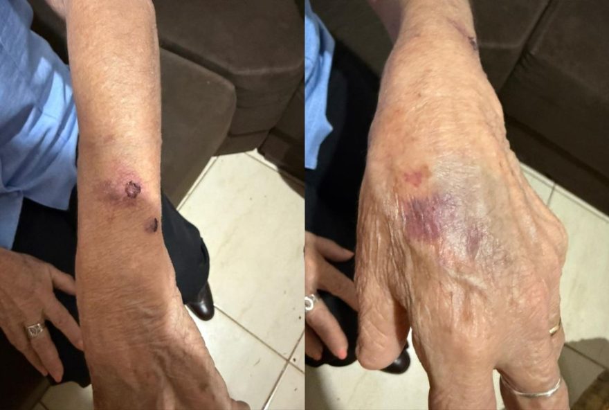 idosa-agredida-e-mantida-em-carcere-pela-filha3A-vizinha-denuncia-e-pm-resgata-vitima-no-parana