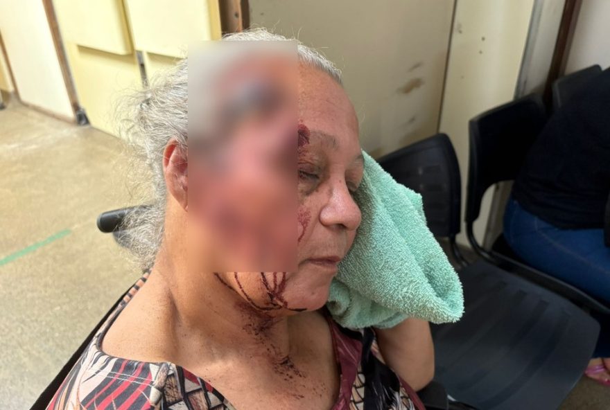 idosa-de-67-anos-cai-e-bate-a-cabeca-ao-descer-de-onibus-em-vicente-pires3A-motorista-nao-prestou-apoio idosa-de-67-anos-cai-e-bate-a-cabeca-ao-descer-de-onibus-em-vicente-pires3A-motorista-nao-prestou-apoio