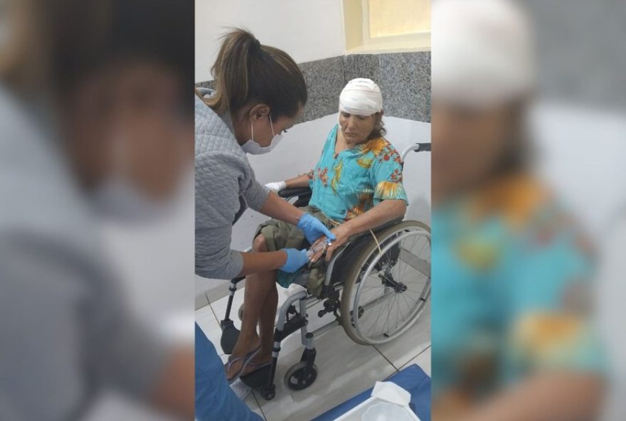 idosa-de-67-anos-e-atacada-por-pitbull3A-tutora-vai-responder-por-omissao-de-cautela