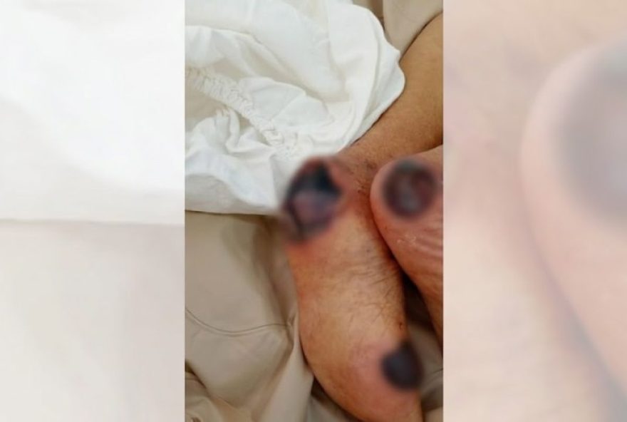 idosa-de-83-anos-morre-com-necrose-em-clinica-de-saude-em-tupa3A-investigacao-em-andamento idosa-de-83-anos-morre-com-necrose-em-clinica-de-saude-em-tupa3A-investigacao-em-andamento