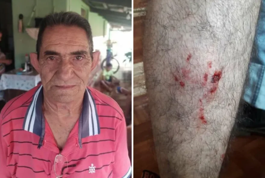 Caciano Moreira de Lima, de 75 anos, foi atacado por um Pitbull que já atacou mais de oito pessoas (Foto: Arquivo Pessoal/Elza Moreira)