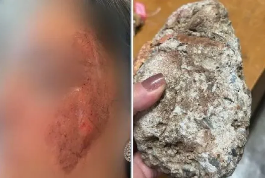 Diretora é atingida por pedra no rosto em portão de escola