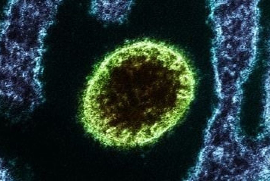 india-entra-em-alerta-devido-a-surto-de-virus-letal-nipah3B-conheca-os-riscos-do-microrganismo