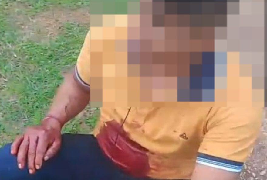 indigenas-parakana-sao-alvo-de-atentado-a-tiros-proximo-a-ti-apyterewa2C-no-pa3A-feridos-devem-ser-transferidos indigenas-parakana-sao-alvo-de-atentado-a-tiros-proximo-a-ti-apyterewa2C-no-pa3A-feridos-devem-ser-transferidos