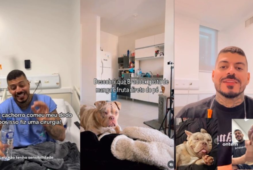 influenciador-de-sc-tem-dedo-do-pe-comido-pelo-cachorro-e-viraliza-nas-redes0A