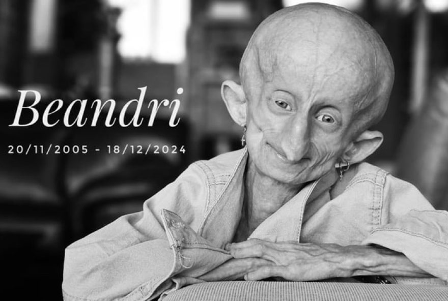 influenciadora-beandri-booysen-morre-aos-19-anos-vitima-da-progeria3A-seu-legado-de-inspiracao-e-positividade