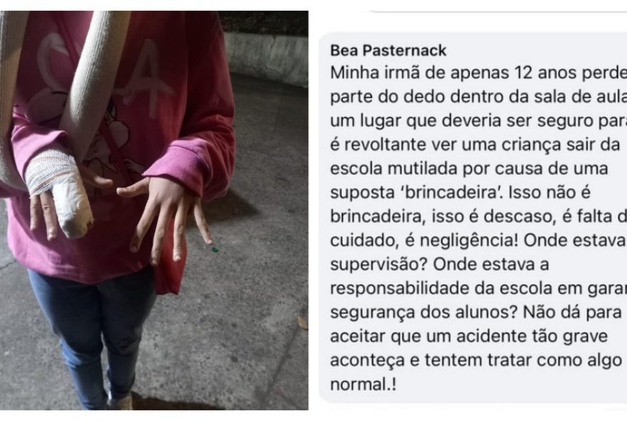 irma-denuncia-negligencia-apos-reimplantacao-impedida3A-estudante-perde-parte-do-dedo-em-escola-de-sp.-seduc-sp-lamentaan-uxo2C-apura-o-caso